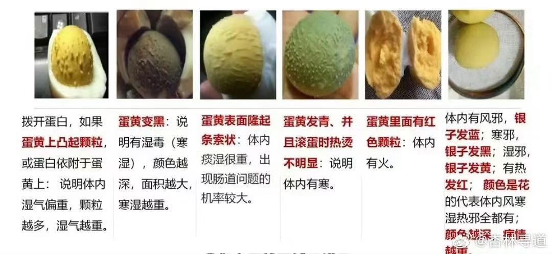 suanguaa's tweet image. 滚鸡蛋是科学还是玄学？

滚鸡蛋学名叫“履蛋收阴术”，确实是正经的外治疗法，是苗族为代表的一种民族医学治疗方法，与中医同属传统医学，在理论基础上是贯通的。…