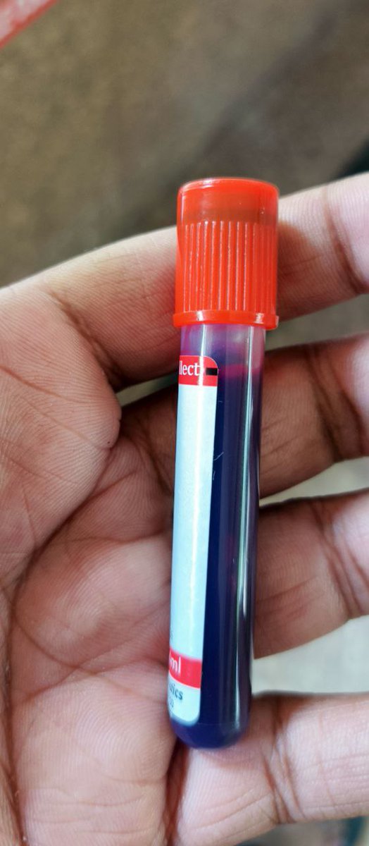 DeVinshh's tweet image. 14 Million 🥳

13M To 14M Not a Piece Of Cake 😞
I Tap on Mobile For The First Time From On Hospital Bed 😑

Now Im Recovered Little Bit N Back To Home Lets Hit 15M Before TurboTap Ends 🙃

Rank - OR 1125 / OR 872

@EclipseFND @Alucard_eth @Azuafunaya_Jnr @goatnataaaaa