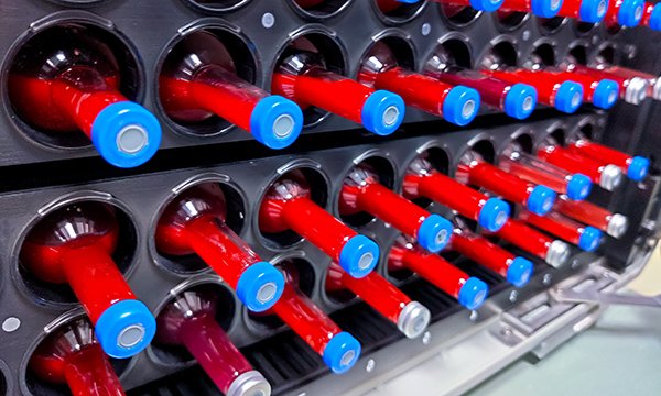 Blood culture pathway: how nurses can improve their practice 

A lead sepsis nurse explains nurses’ role in the blood culture pathway and how consistent best practice improves patient care.

rcni.com/nursing-standa…