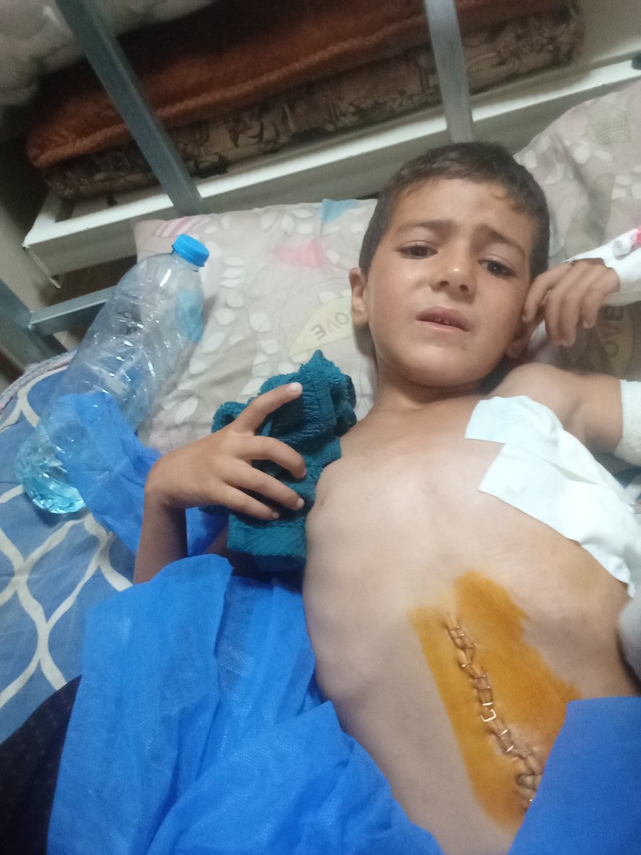 After my son came out of surgery, after four hours, the bullet did not exit my little son’s body. My heart aches for بعد خروج ابني من العمليات بعد اريع ساعات لم تخرج الرصاصه من جسم ابني الصغيرانا قلبي يالمني علي chuffed.org/project/yasmin…طفاليmy children.