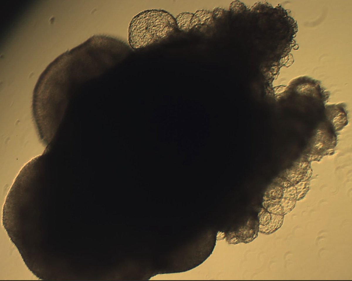 SevdeAltuntas's tweet image. 41st culture day of 150 days for full-thickness skin organoids...
@SBUDETUAM #AltuntasLab #41kereMaşaAllah