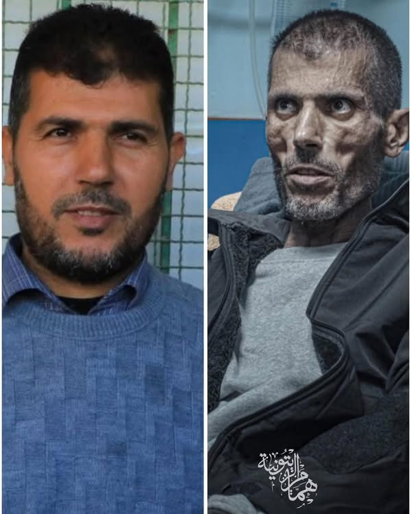 This is Ibrahim al-Shawish, a Palestinian teacher, before and after he was abducted by Israeli forces from Gaza.

For 45 days, he was blindfolded, shackled, and forced to kneel. In Naqab prison, they electrocuted him. Set dogs on him. Denied him food. He returned home