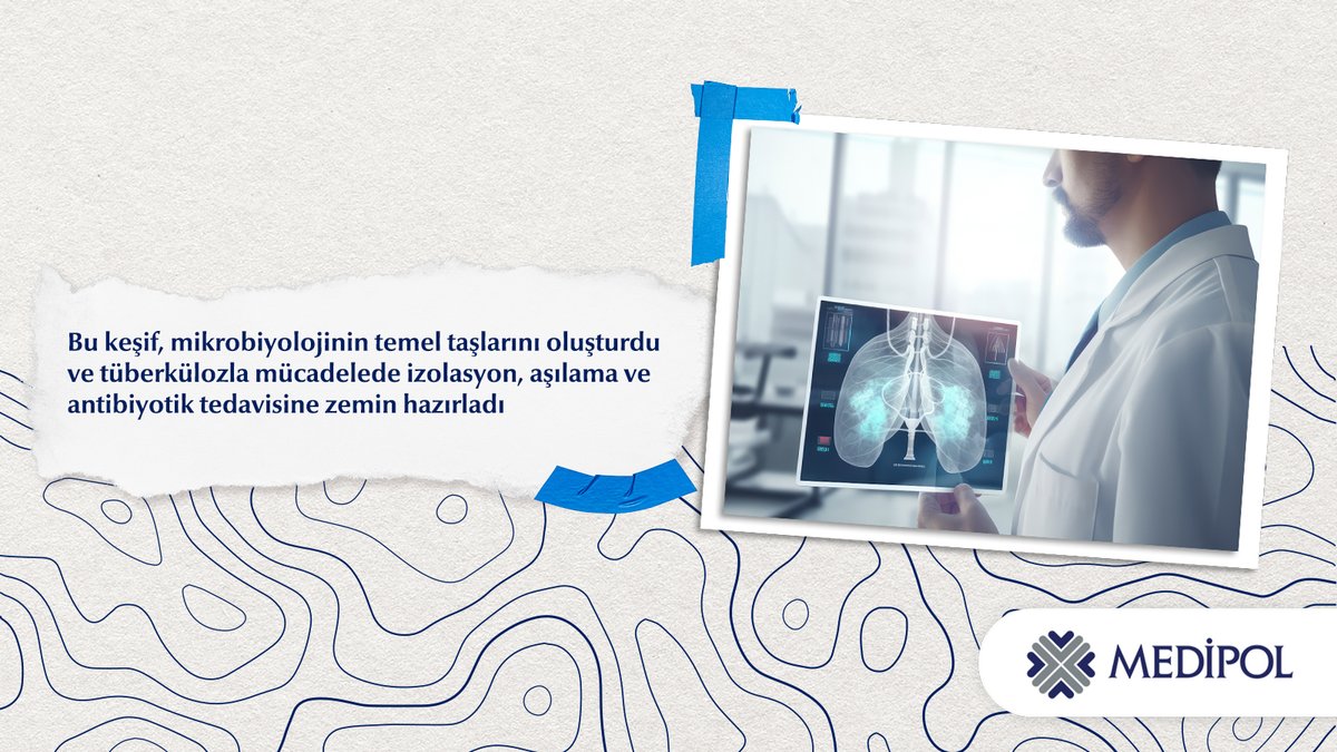 🦠 1882’de Robert Koch, mycobacterium tuberculosis bakterisini keşfederek tüberkülozun bulaşıcı olduğunu kanıtladı.

🔬 Mikroskobik inceleme ve tüberkülin testi, hastalığın teşhisinde devrim yarattı.

💉 Bu keşif, izolasyon, aşılama ve antibiyotik tedavisine zemin hazırlayarak