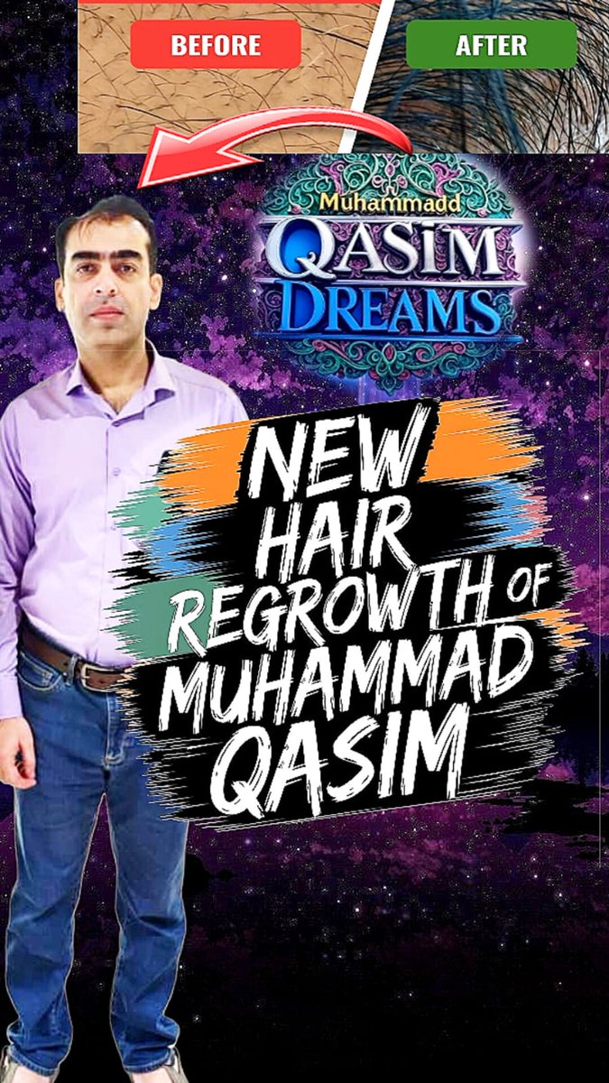 a_muhammad51674's tweet image. 📷 Visible proof.
Muhammad Qasim’s appearance has visibly transformed between Sep 2024 and Mar 2025.
Growth after 40s—unheard of. Yet it&apos;s happening.

#LookAtQasimElon #QasimFeetElongation #MuhammadQasim
