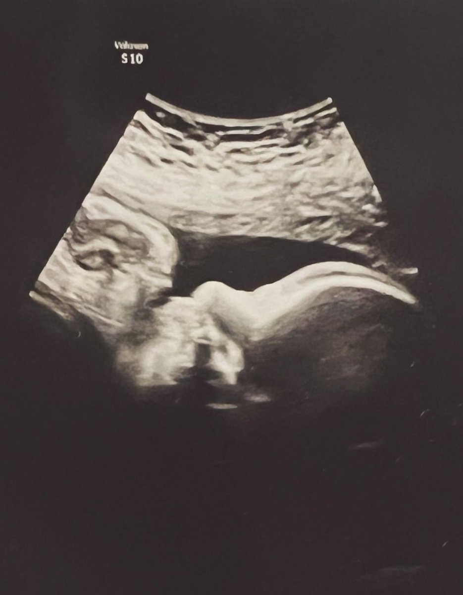 _meetalyssa's tweet photo. I can’t wait to welcome you into this world. River Chase, coming in the next few hours 💙❤️ https://t.co/FEopXEslCa