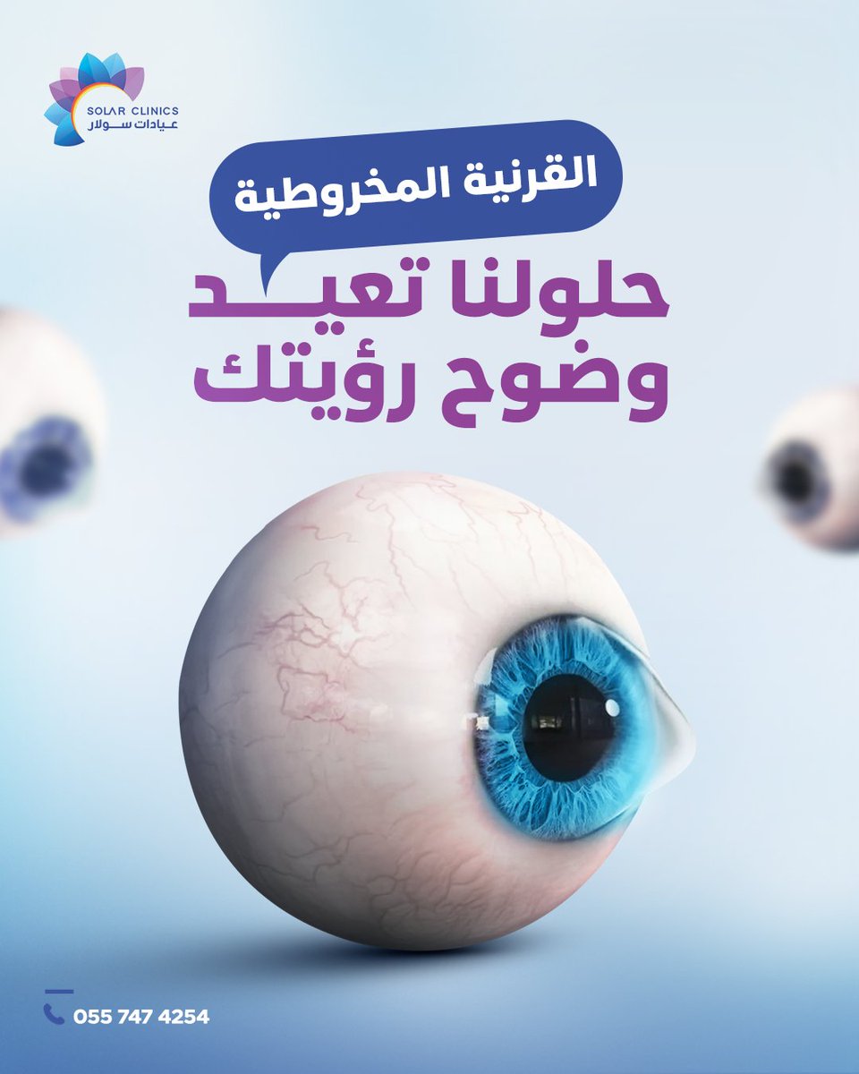 تعاني من تشوّش في الرؤية وحساسية مفرطة للضوء؟ 

كل هذه الأعراض من علامات القرنية المخروطية ✅
 وهي حالة تغير شكل القرنية من دائري إلى مخروطي، مما يؤدي إلى تشوه الرؤية وصعوبة في وضوحها.  

في عيادات سولار نوفّر أحدث الخيارات لعلاج القرنية المخروطية:
1️⃣ التثبيت الضوئي للقرنية