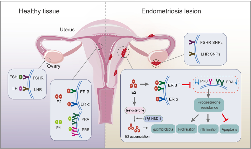 doctorneyro's tweet photo. An unbalanced #redoxstate, including impaired #mitochondrialfunction, dysregulated #lipidmetabolism, and #iron induced #oxidativestress, generates a #prooxidative #microenvironment, which negatively impacts #oocytequality and #sperm and #embryoviability.
https://t.co/xt7rEX68S8 https://t.co/8Ocmz36k6q