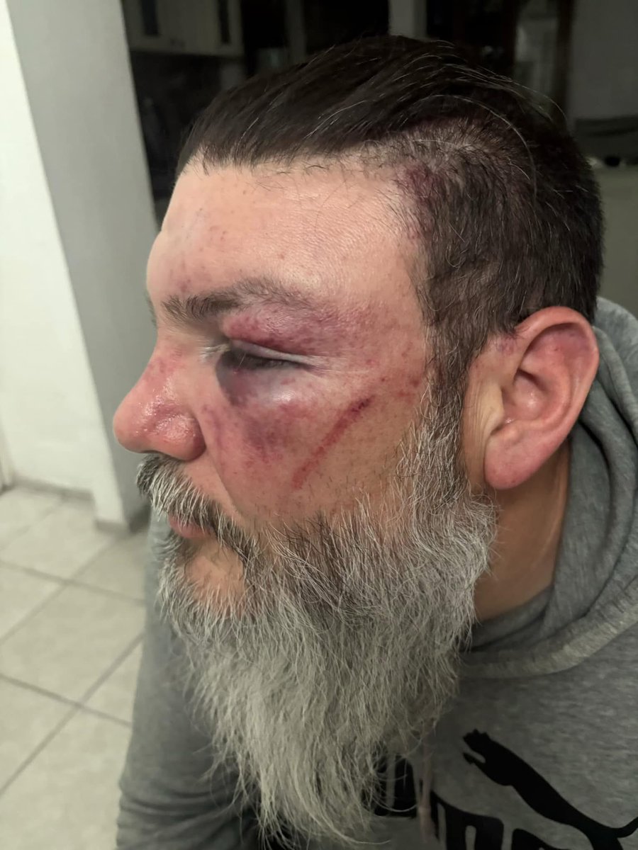 ALunaSilva's tweet image. ‼️ #INDIGNANTE ‼️ 

Anoche, sólo por portar una gorra de #Pumas, su equipo, Fer Jara, conocido como Brujo Knibal, conductor de @SICOMPue y “El Fusil”, fue golpeado por un grupo de aficionados del #CruzAzul al salir del Estadio Cuauhtémoc de #Puebla.

🚨 Teme por su seguridad y la