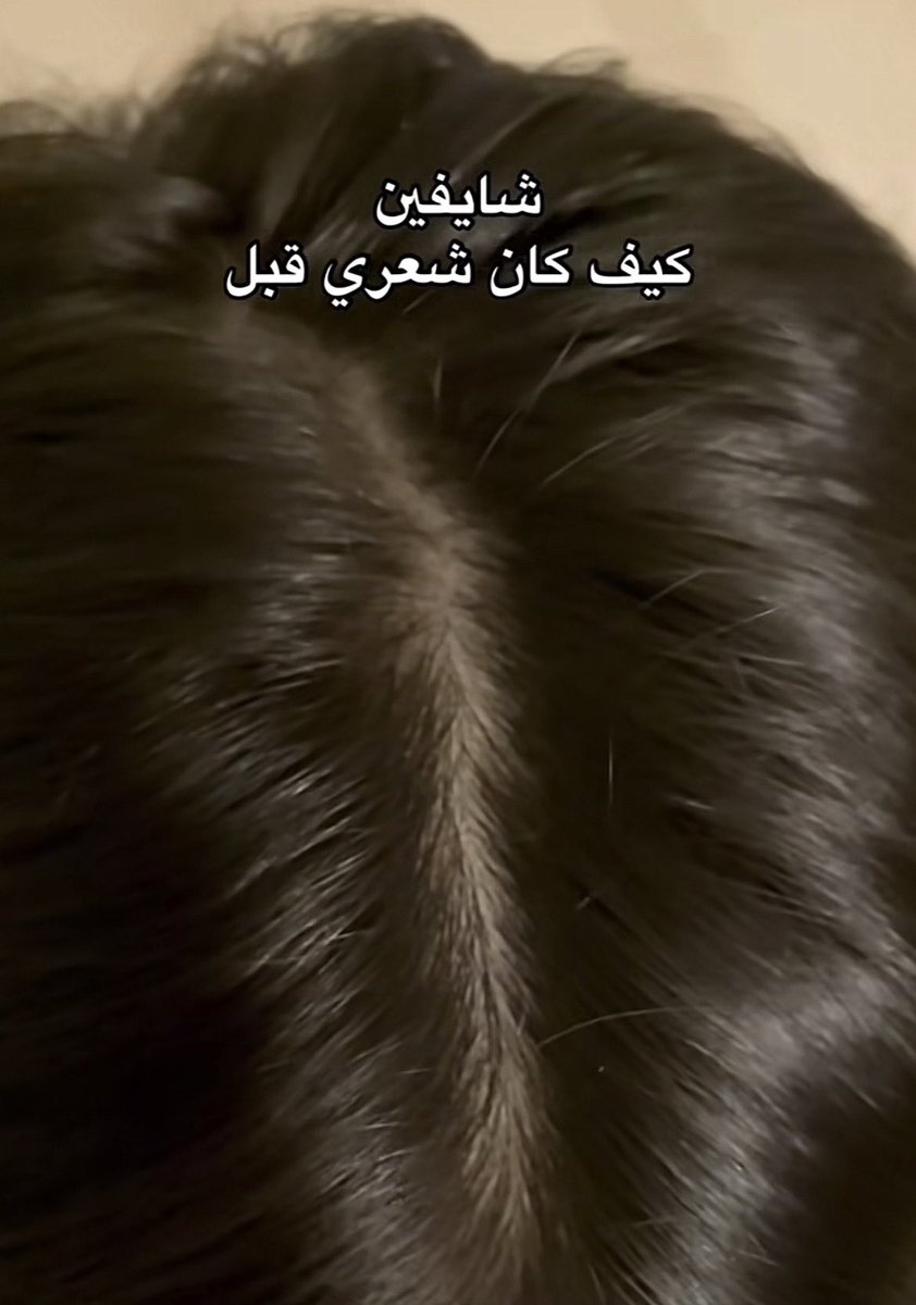 fa_my4's tweet photo. اللي تبغا شعرها كثيييفففف كثيففففف وربي عن تجربببببه لا تتعداه كثف شعري بشكل خياااالي تتوقعون وش هو؟! https://t.co/r2ztvQisVa