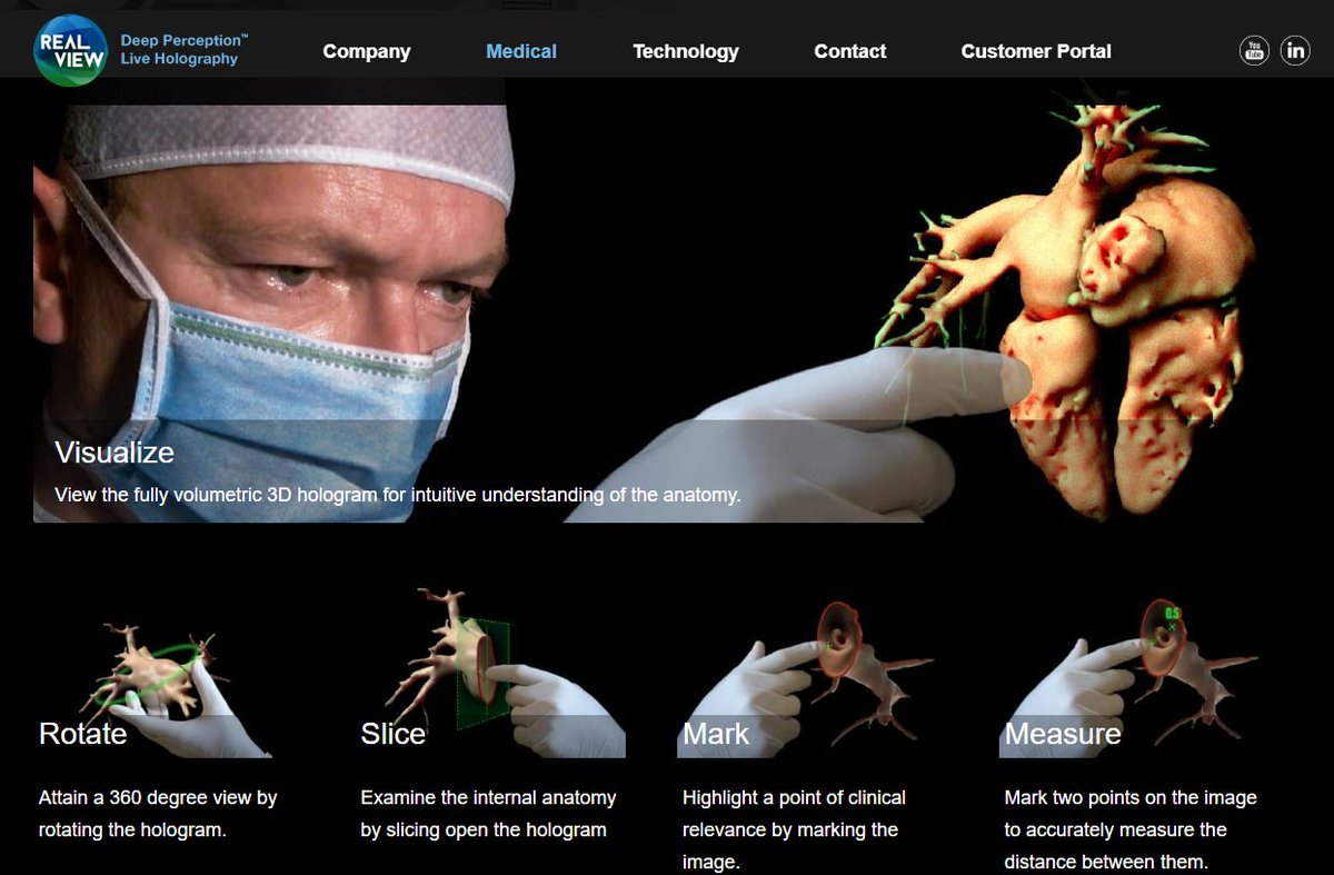 El dimarts 8 d'abril a les 8:15h gaudirem de la sessio sobre l'us d'una tècnica única per guiar les intervencions cardiovasculars - hologrames en real life. Per primera vegada a Can Ruti. Vine i no t'ho perdis. <a href="/hgermanstrias/">Hosp. Germans Trias</a> <a href="/GTRecerca/">IGTP</a> 
youtu.be/KLQCbDbljik