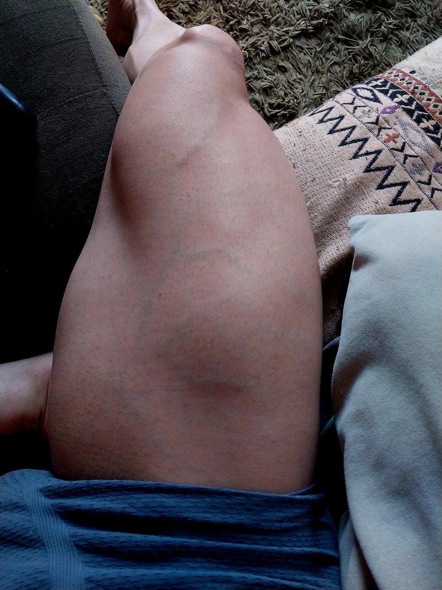 cezarmoabi's tweet photo. Dps de tanta kikada na gaiola e no leg https://t.co/cxQMmwyCGh