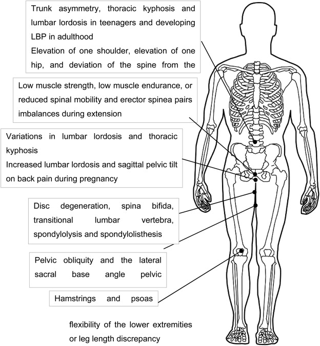 DavidMackeyDPT's tweet image. Should we use the postural structural biomechanical model?
Postural/structural asymmetries don&apos;t cause back pain; they&apos;re normal variations. Correcting these factors is not clinically attainable and unlikely to change the course of lower back conditions.
pubmed.ncbi.nlm.nih.gov/21419349/