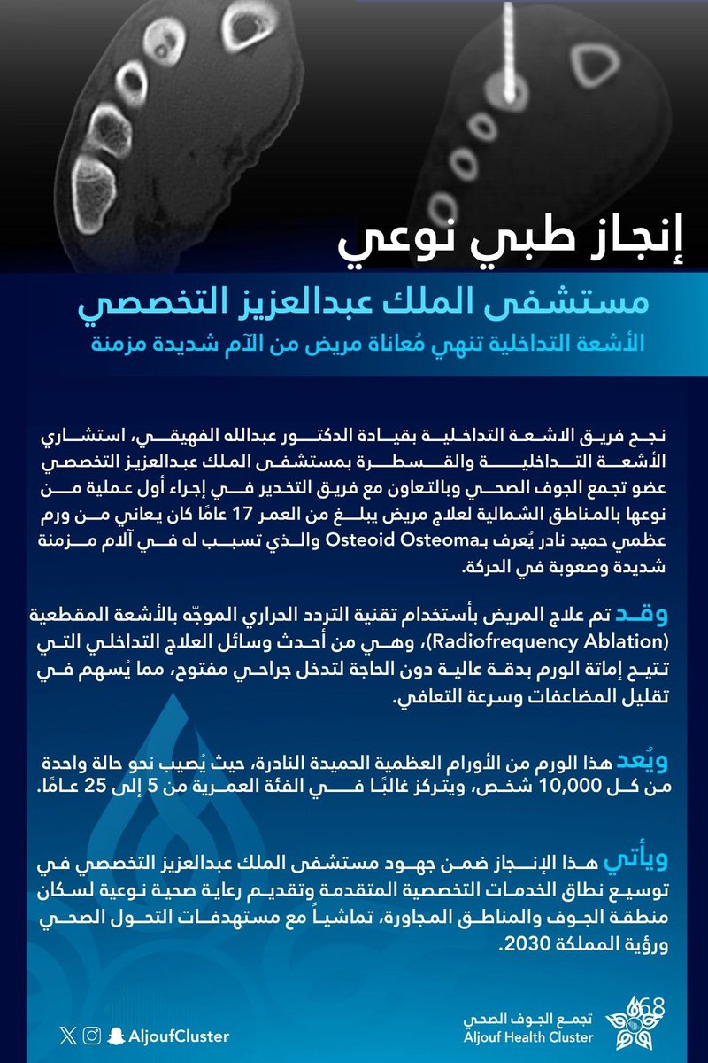 في إنجاز طبي نوعي يُعد من أحدث الأساليب الطبية.

الاشعة التداخلية و القسطرة في مستشفى الملك عبدالعزيز التخصصي بالجوف تنهي معاناة مريض من آلام شديدة مزمنة نتيجة ورم عظمي حميد نادر.

#تجمع_الجوف_الصحي