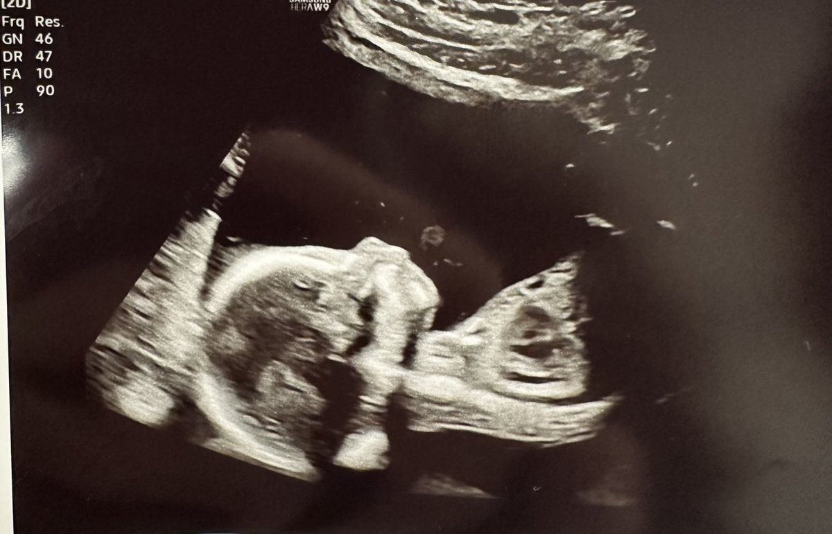 Ryan Depaulo tweet media