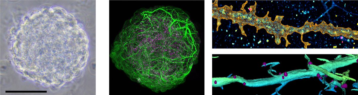 With Ed Cohen (Imperial College London) we are recruting 2 PhDs for a nice project called "Deciphering the functional architecture of neuronal proteins using 3D SMLM, artificial intelligence and robust statistics". More information here : ma.imperial.ac.uk/~eakc07/Imperi…