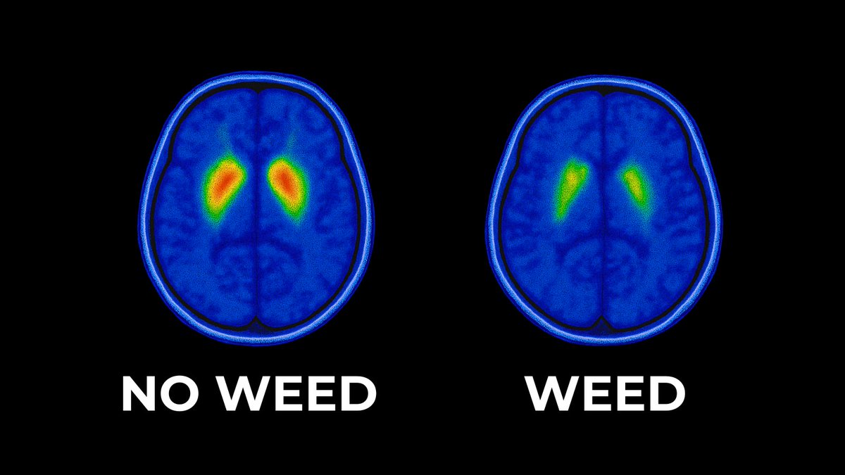 The most misunderstood drug in the world:

Weed.

It can either ruin your life or make it better.

Here's what it does to you (backed by science):