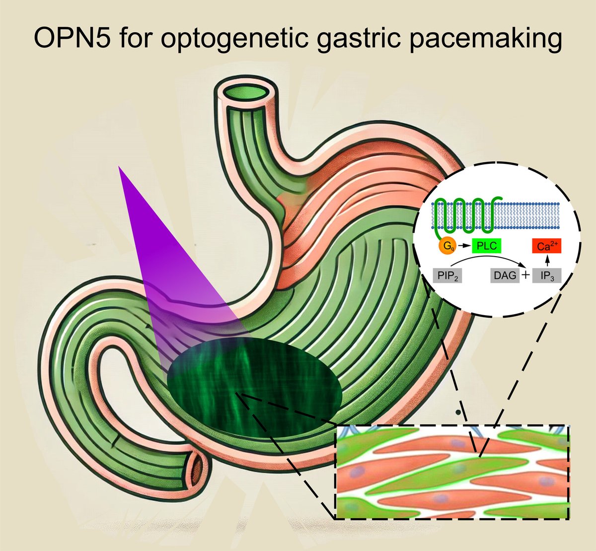 NGMJournal's tweet image. 🆕🔥Direct Stimulation of #Gastric #SmoothMuscle cells via Gq proteins with #Light‼️
✅#hOPN5 is a🆕tool to directly stimulate gastric SMC to control contractility👏
🎯A new opportunity to restore gastric contractility #Gastroparesis
👉onlinelibrary.wiley.com/doi/10.1111/nm…
@ANMSociety @esnm_eu