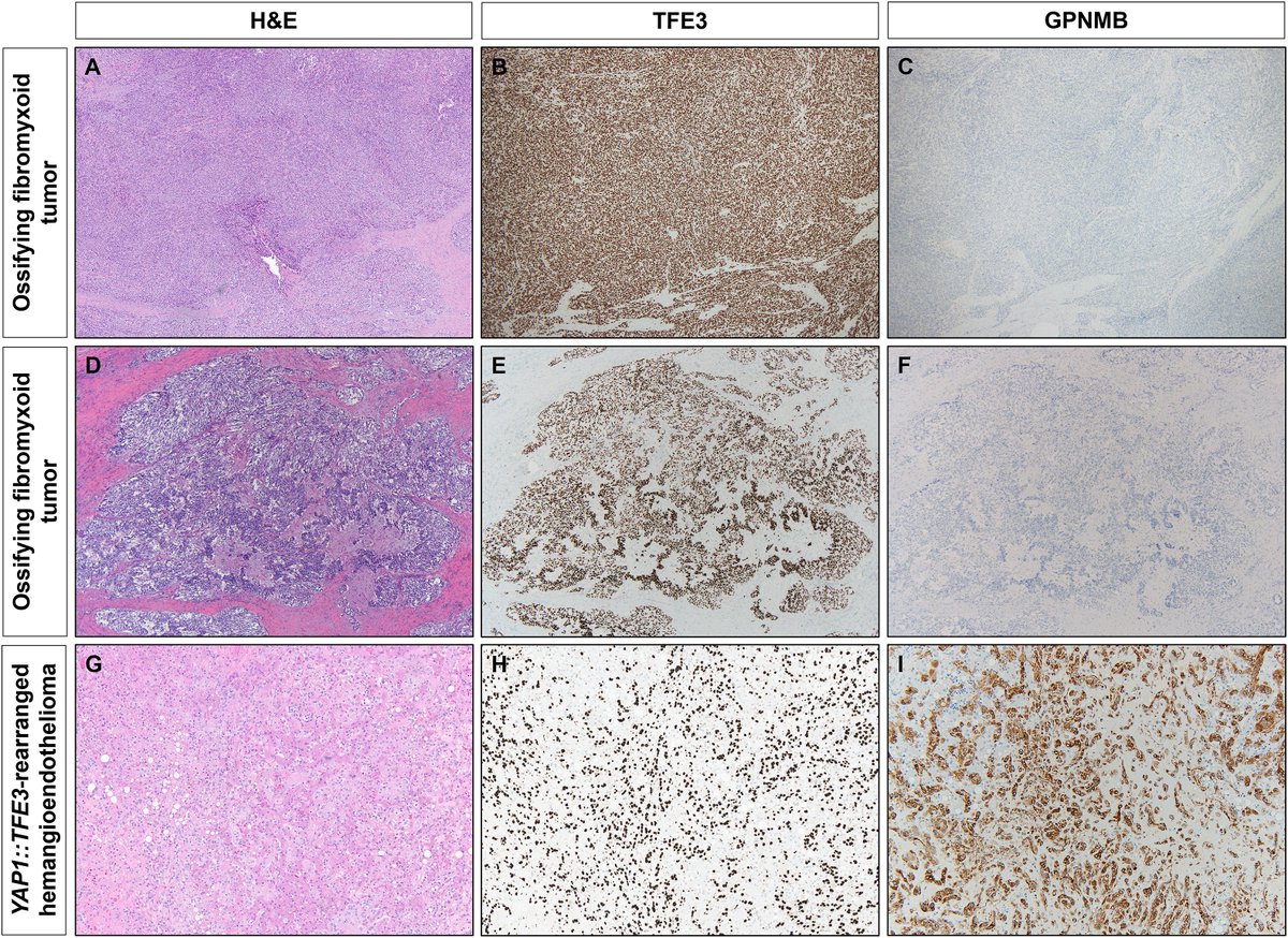 Human Pathology tweet media