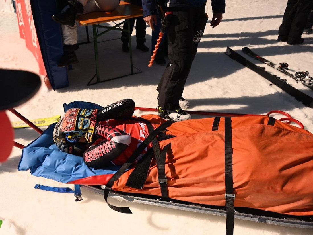 CumbresMagazine's tweet image. La campeona mundial de esquí Federica Brignone 🇮🇹 fue operada de urgencia tras fracturarse la tibia y el peroné en una caída durante la competencia. Su participación en los Juegos Olímpicos de Milán-Cortina 2026 ⛷️podría estar en riesgo.
👉tinyurl.com/2bl2bxtl