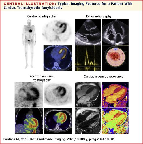 BSCMR (@bscmr) on Twitter photo The Last Decade in Cardiac Amyloidosis: Advances in imaging 🧲have transformed diagnosis & treatment. Read more: tinyurl.com/Amyloidai <a href="/MariannaFonta11/">Marianna Fontana</a> <a href="/JccmoonMoon/">James moon</a> <a href="/DorbalaSharmila/">Sharmila Dorbala</a> <a href="/dr_a_ioannou/">Adam Ioannou</a>
BSCMR President <a href="/SaulMyerson/">SaulMyerson</a> The Last Decade in Cardiac Amyloidosis: Advances in imaging 🧲have transformed diagnosis & treatment. Read more: tinyurl.com/Amyloidai <a href="/MariannaFonta11/">Marianna Fontana</a> <a href="/JccmoonMoon/">James moon</a> <a href="/DorbalaSharmila/">Sharmila Dorbala</a> <a href="/dr_a_ioannou/">Adam Ioannou</a>
BSCMR President <a href="/SaulMyerson/">SaulMyerson</a>