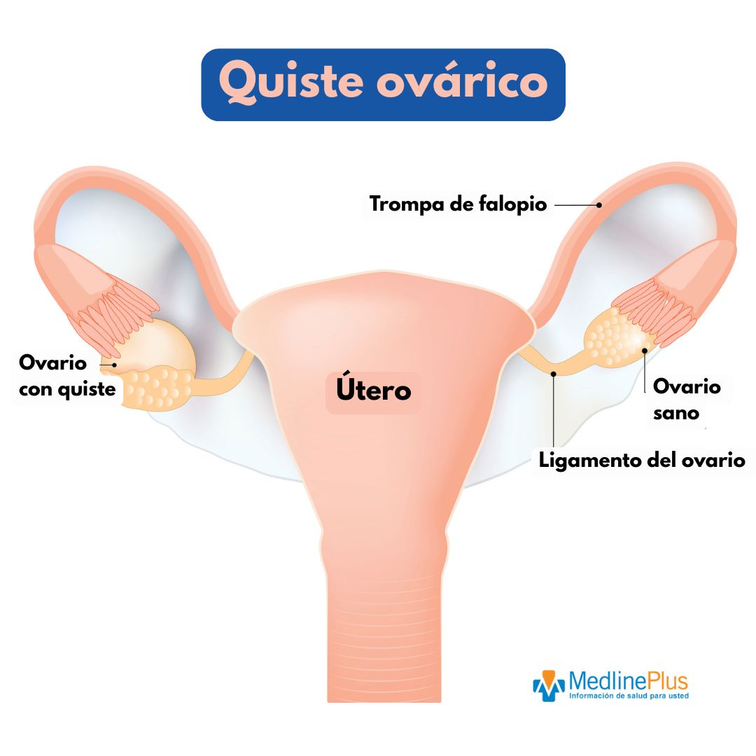 MedlinePlus Español tweet media