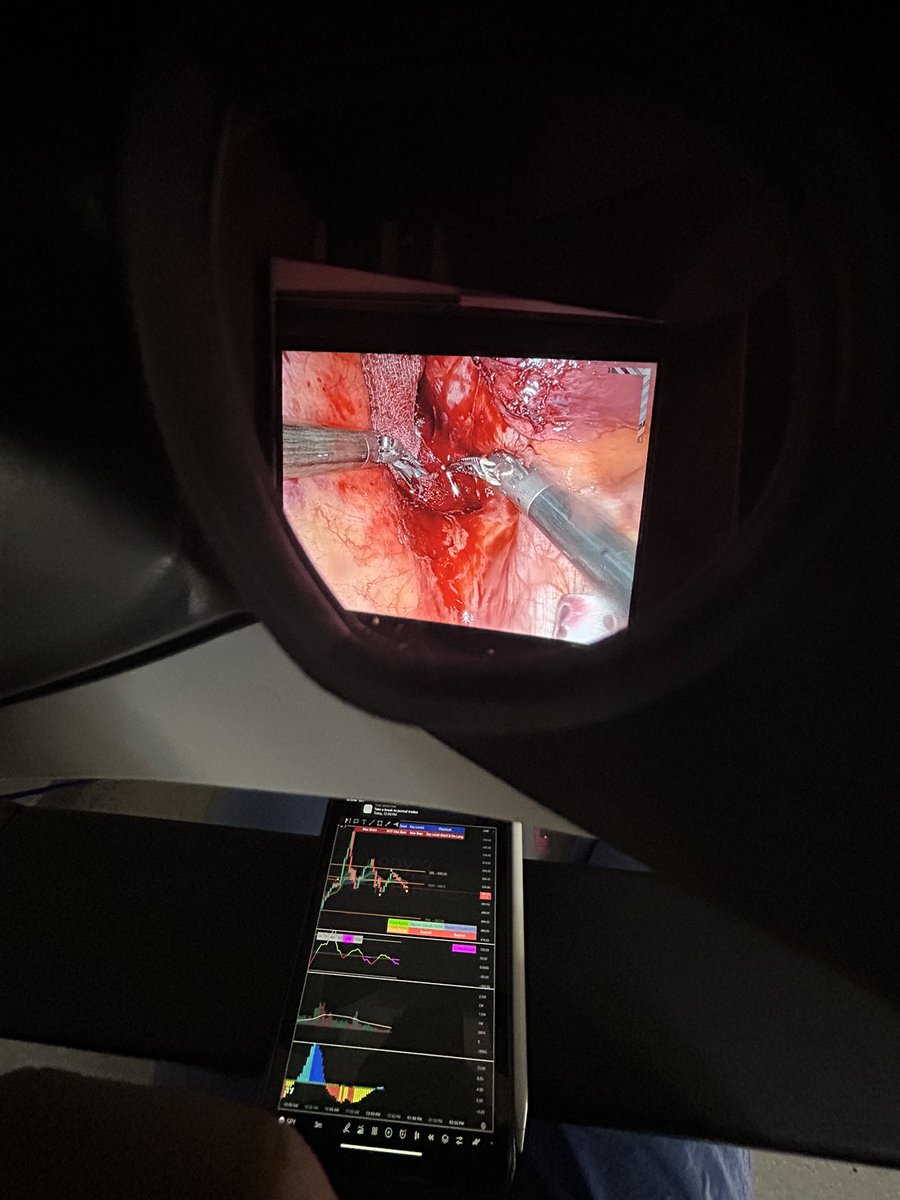 MDTrader tweet media