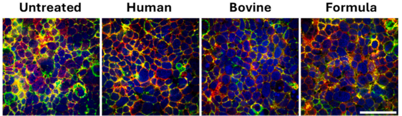 #extracellularvesicles from milk (either human, bovine, or formula) have a regulatory role in intestinal barrier function. Interestingly, in this study #milkEVs boost intestinal permeability for nanoparticles and macromolecules
sciencedirect.com/science/articl…