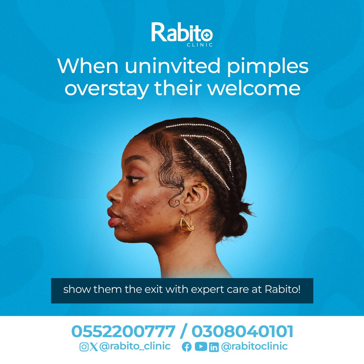 rabito_clinic's tweet image. Our experts clear stubborn breakouts fast so your skin can glow. Book your treatment today!

#pimples #breakouts #skintreatment #Rabito #april