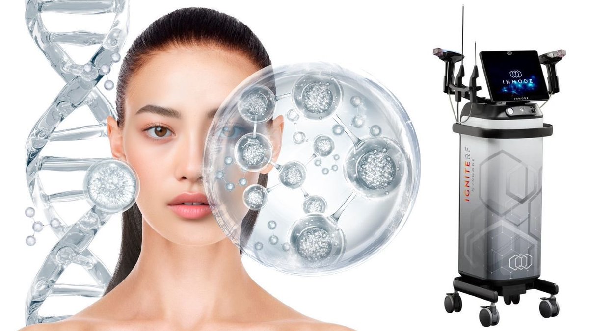 Ameliyatsız Yüz Gençleştirmede Mucize Yöntemler; Morpheus 8 ve Quantum RF

Doktor <a href="/estetkcerrahSBB/">Dr. Serdar Bora Bayraktaroglu, MD. PhD.</a> voxaesthetic.com kış sayısı için harika bir yazı yazdı✨
Keyifli okumalar🌸
Yazıya aşağıdaki linkten ulaşabilirsiniz👇🏻

voxaesthetic.com/tr/article/?ti…

#morpheus8 #ignite #quantumrf