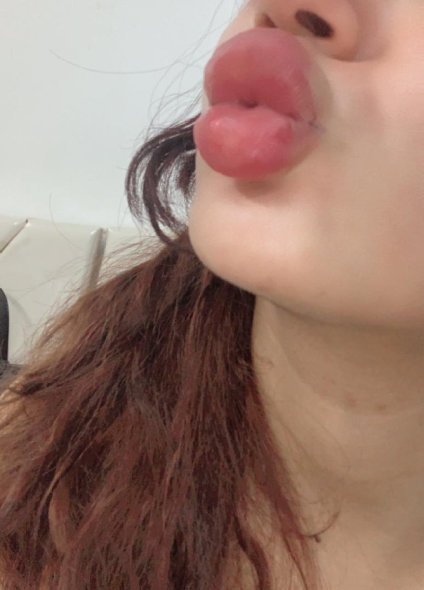 fop0i's tweet photo. حسابي الجديد تلجرام تعالو مسويه عروض على الاشتراك 🥳😍🔥

https://t.co/DmrXY3upim https://t.co/tpGrRj9LM3