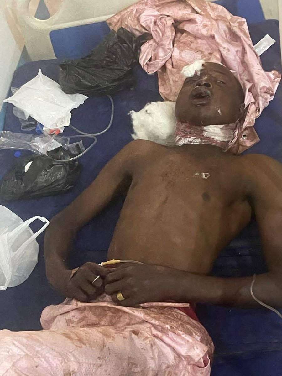 Sadeeq_Malo's tweet image. Wannan Bawan AllahN Yayi Accident Yana Aminu Kano An Tambayeshi Yace Sunansa Abba Dan Gidan Yakubu Kuma A Kunya Dan Allah A Bincika Ko Za a San Wanda Ya Sanshi

Retweet This fisabilillahi God Bless You all😥🙏💔