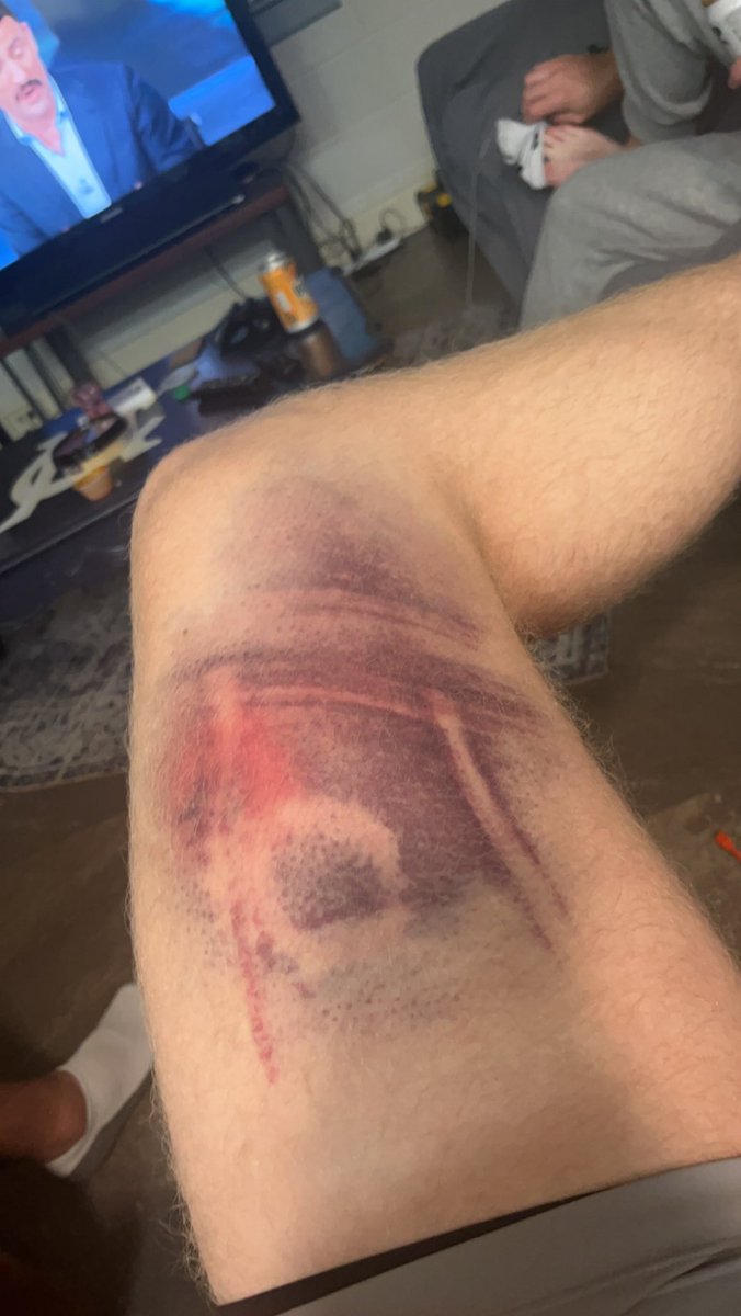 One of my favorites 🤣looks like a baseball diamond