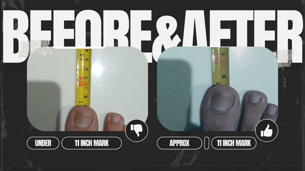 AfiaSalma10's tweet photo. 📈 Muhammad Qasim, age 49, has grown taller — by up to 2 cm.
🦶 His feet have also elongated by over 1 cm.

No stem cells, no procedures.
Medical science is baffled.
#QasimsSigns #ElonSeeQasimSigns https://t.co/wJxbIq95ef