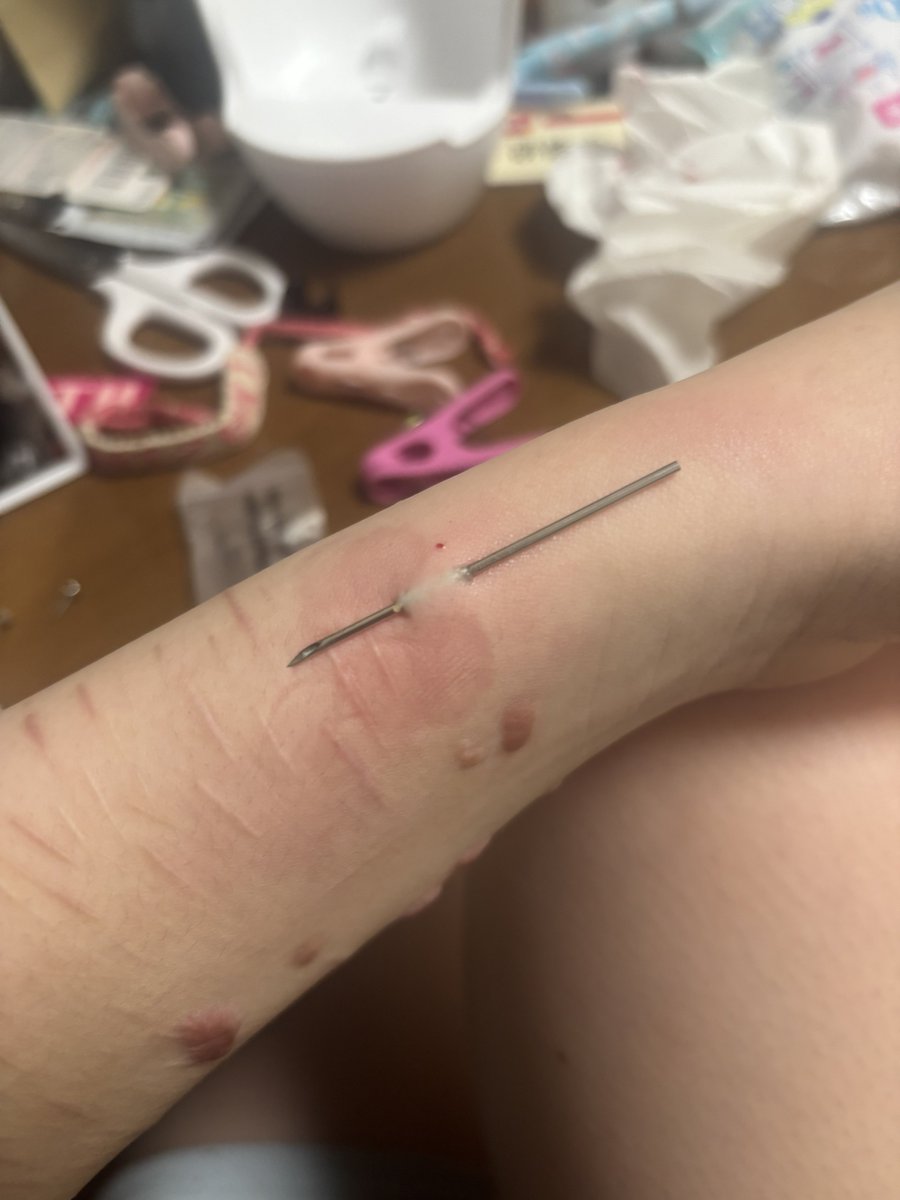 ピアス用意してないのにぶっさちちゃった