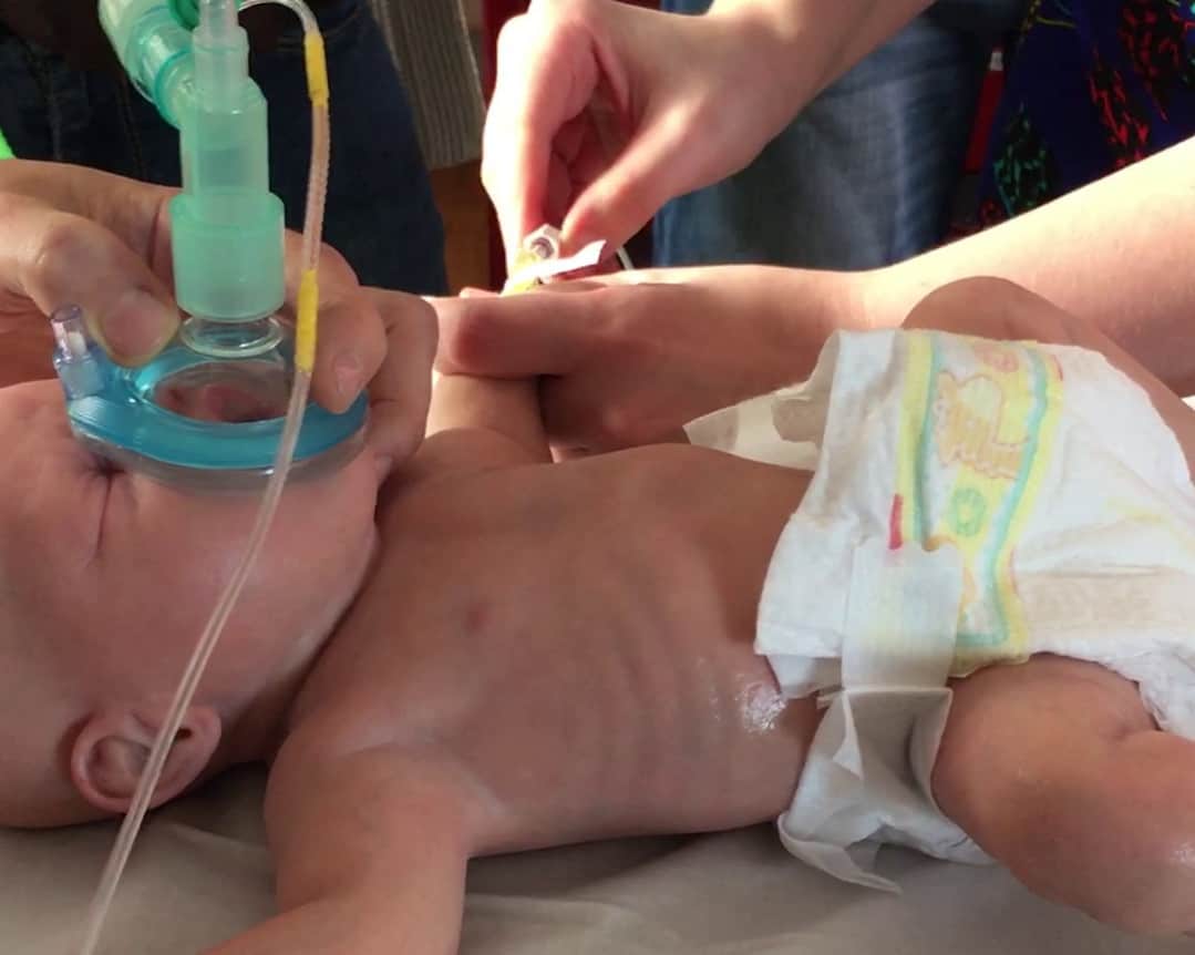 Intubation Course on 6th May is now sold out, however there are still a few places left on Paediatric Emergencies Simulation Course taking place in Belfast on 7th May. 8 great cases covering common Paeds Emergencies with expert faculty paediatricemergencies.com/simulationcour…