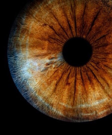Спустя 25 лет жизни узнала, что у меня частичная гетерохромия, и вблизи моя радужка выглядит вот так