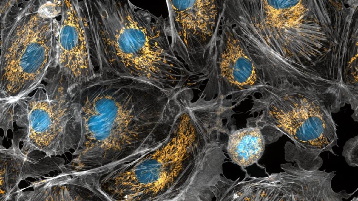 MarioNawfal's tweet image. 🚨FIRST-EVER HUMAN BRAIN MITOCHONDRIA MAP REVEALED

In a major scientific leap, researchers have created the first full map of mitochondria across the human brain—charting how these energy-producing structures vary by region.

Some brain areas, especially evolutionarily newer…