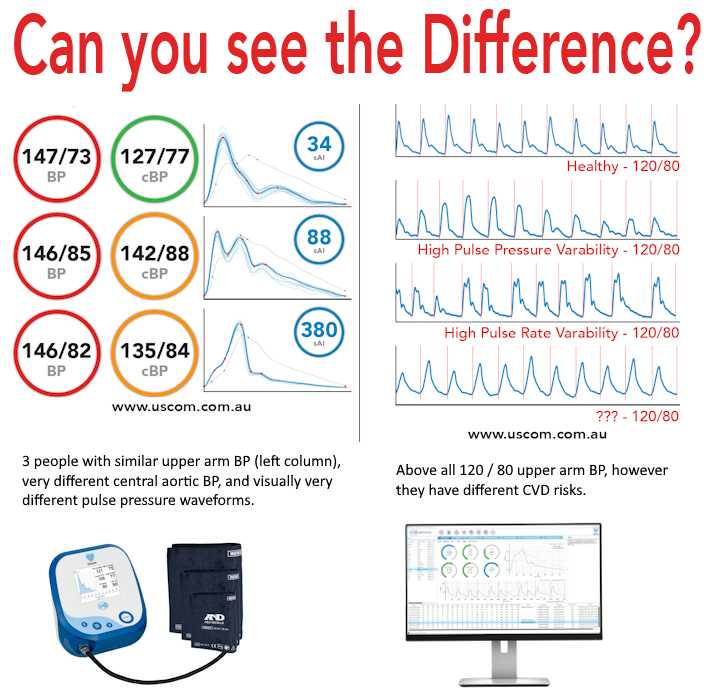 Uscom's tweet image. 🌍 #WorldAdherenceDay 🌍
Stay on track of your patients’ health using the #UscomBP+!
This easy-to-use device measures both upper arm and central aortic BP and other #PulseWave measures, providing unique insights into cardiovascular health not possible with regular BP.