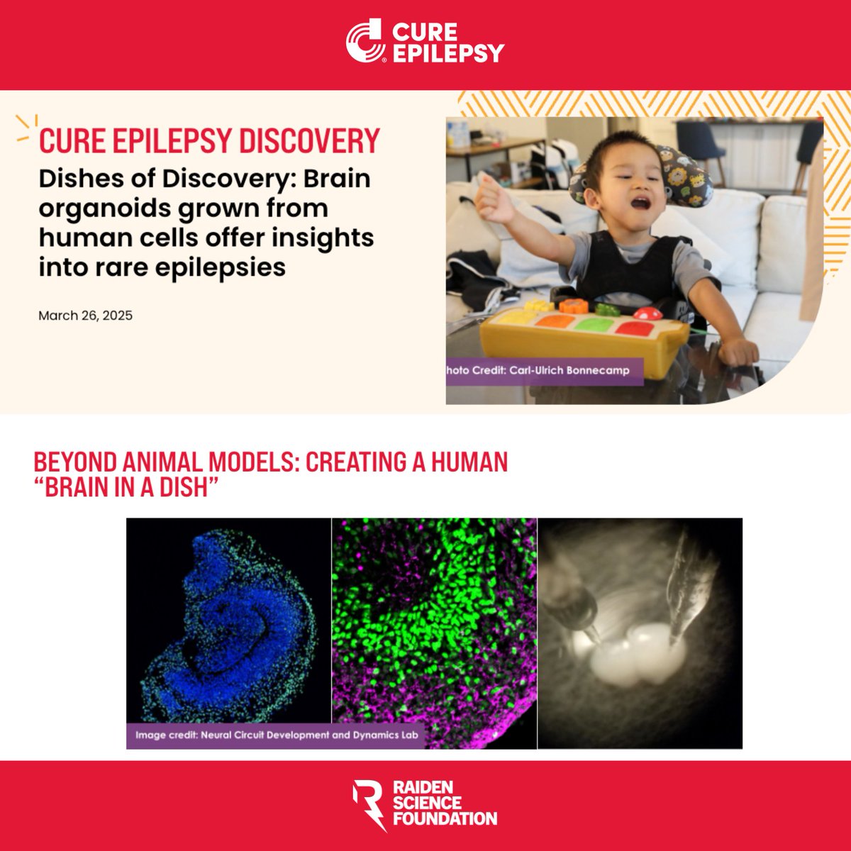 RaidenScience's tweet image. Check out the innovative research led by
@hcmeffordthat, that we have been supporting at
@StJudeResearch in partnership with @CureEpilepsy
🧠🔬
Read the full article here: bit.ly/4bOwOpk