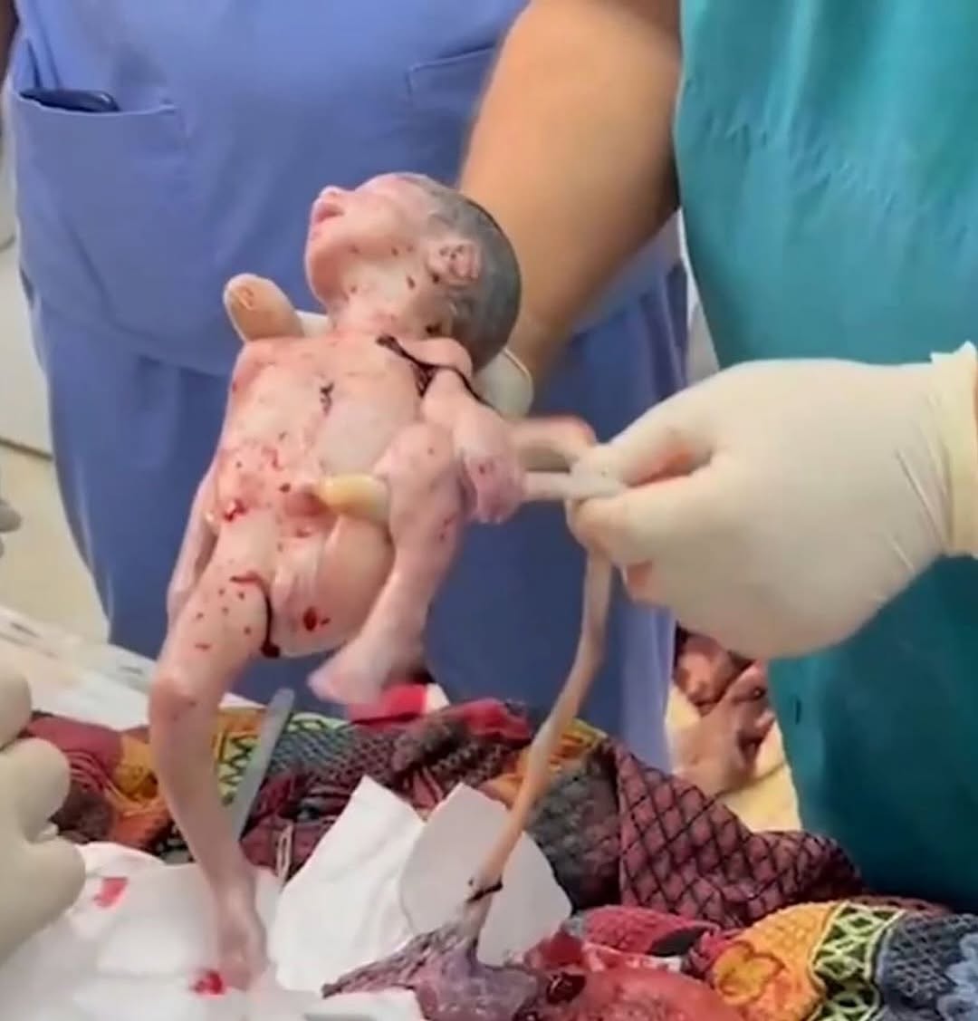 Ya Kahhar.. Terörist İsrail, Gazze'de kadir gecesinde anne karnındaki doğmamış bebeği katletti.
