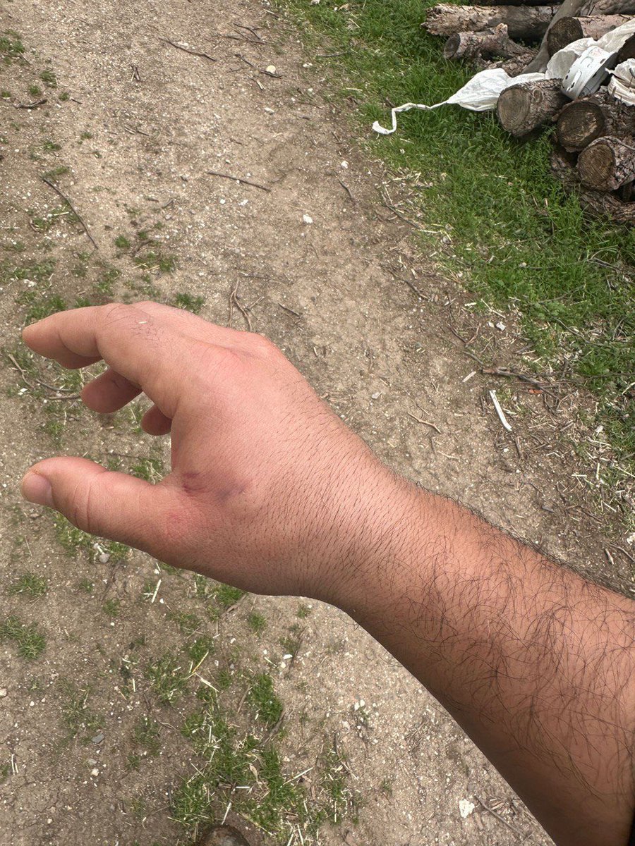 Uşak📍

Ulubey İlçe Tarım ve Orman Müdürlüğünde görevli meslektaşımız Veteriner Hekim Necip Emirbey, büyükbaş hayvan brusella aşı uygulaması sırasında hayvandan darbe alarak #işkazası geçirdi. 

Kendisine geçmiş olsun diyoruz ve elimizden alınan Fiili Hizmet Zammı hakkımızı geri