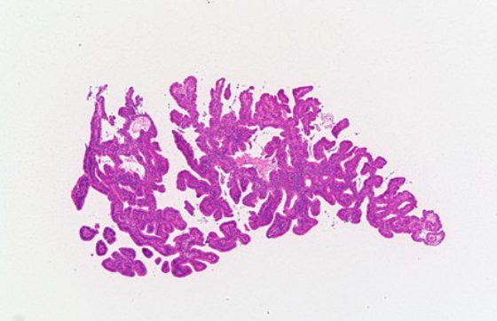 Gunt A.B tweet media