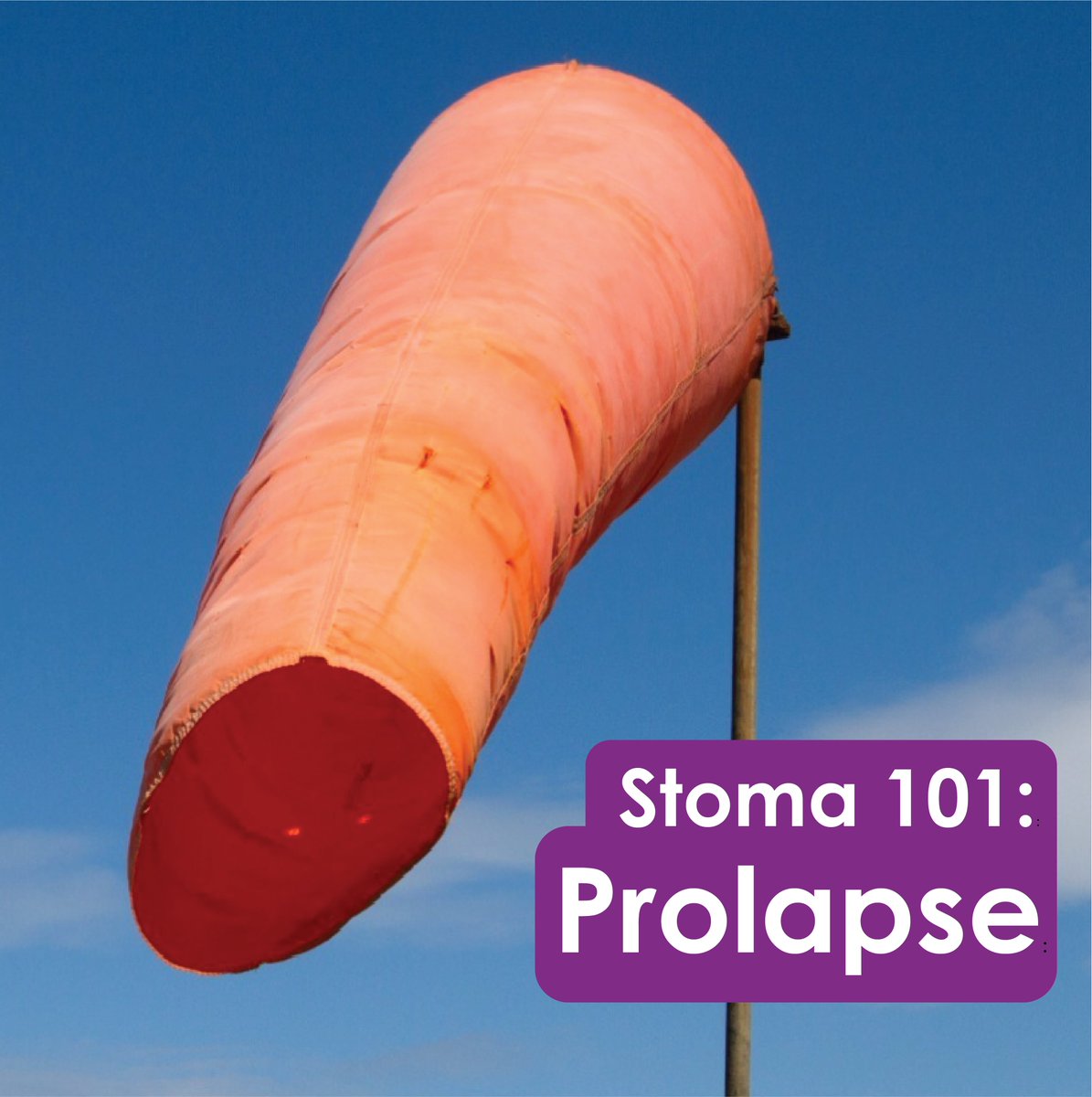 A prolapsed stoma occurs when the bowel protrudes through the stomal opening to a greater extent than anticipated. When this first happens, it can be very distressing.
These can be managed conservatively or surgically: colostomyuk.org/information/st…

 #Stoma101