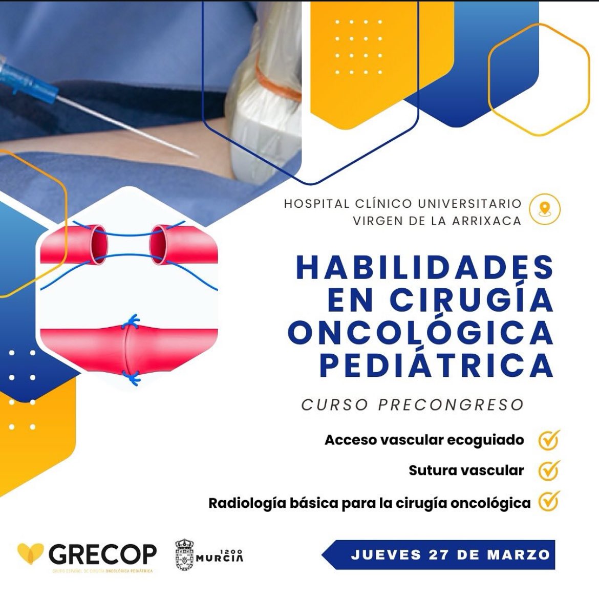 Guillen_CirPed's tweet photo. Celebramos una década desde la creación del Grupo Español de Cirugía Oncológica Pediátrica @GRECOPspain en Murcia, de la mano del organizador local, nuestro querido @oscargironv . Hoy calentamos motores con los cursos pre-congreso 🙌🏼 @SECIPE https://t.co/NMwckbXM3G