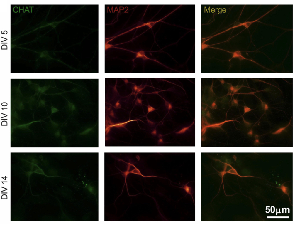 New paper in collaboration between <a href="/Cbv_SAS/">Centre of Biosciences SAS</a> &amp; <a href="/CharlesUniPRG/">Charles University</a> - Electrophysiological characterization of sourced human iPSC-derived motor neurons #ionchannels #mnd #als ➡️ rb.gy/5tdf7r