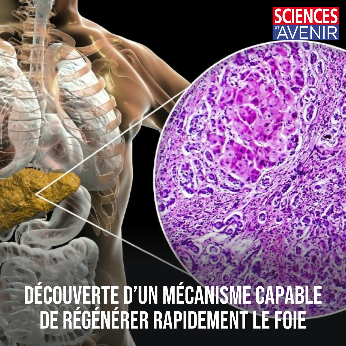 Grâce à un traitement à base de glutamate, l’organe se remet à neuf en quelques jours seulement chez la souris. Un espoir pour le traitement de la cirrhose ou du cancer du foie ! 
👉 l.sciencesetavenir.fr/pZ5