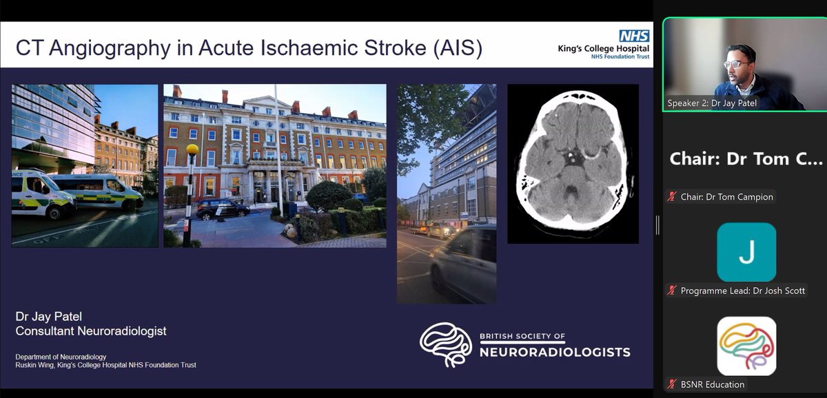 BSNR (@thebsnr) on Twitter photo Already on session 3 of our monthly core neuro training programme - Dr Jay Patel taking us through CTA after an excellent intro on acute ischaemia from our programme lead <a href="/fjhscott/">Josh Scott</a>. Open and free to all UK ST1-3 radiology trainees, still time to sign up!
bsnr.org.uk/education/bsnr… Already on session 3 of our monthly core neuro training programme - Dr Jay Patel taking us through CTA after an excellent intro on acute ischaemia from our programme lead <a href="/fjhscott/">Josh Scott</a>. Open and free to all UK ST1-3 radiology trainees, still time to sign up!
bsnr.org.uk/education/bsnr…