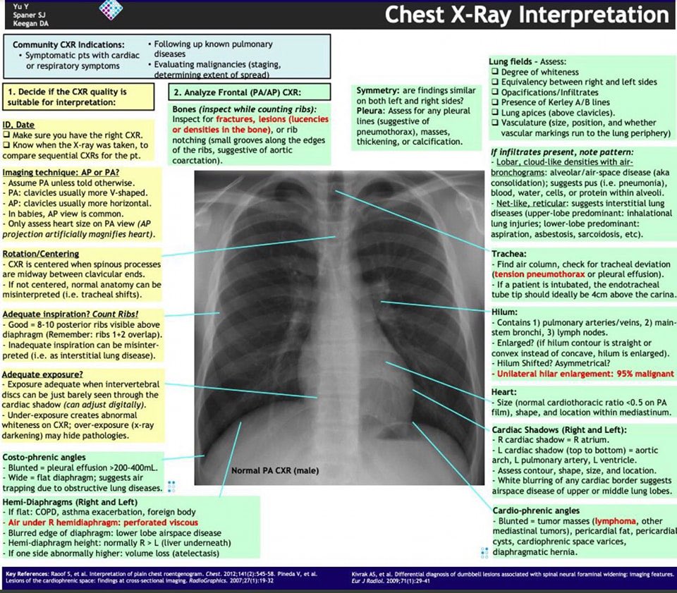 AppCardioNova's tweet photo. Infografía sobre la Interpretación de Radiografía de Tórax 👇🏼

Guarda y Comparte 🔄 https://t.co/Gz5ieJVrO3