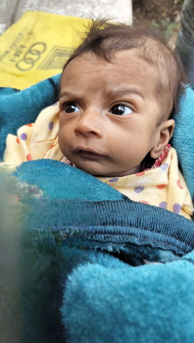 CollectorRjt's tweet image. જામકંડોરણા તાલુકાના હરિયાસણ ગામમાં ખેત મજૂરી કરતા પરિવારના હરમલ વસુનીયાને RBSK પ્રોગ્રામ અંતર્ગત NICU રાજકોટ અને NRC રાજકોટ માં સઘન સારવાર કરી SAM(Severe Acute Malnutrition)માંથી બહાર લાવી બાળક થયુ સ્વસ્થ.