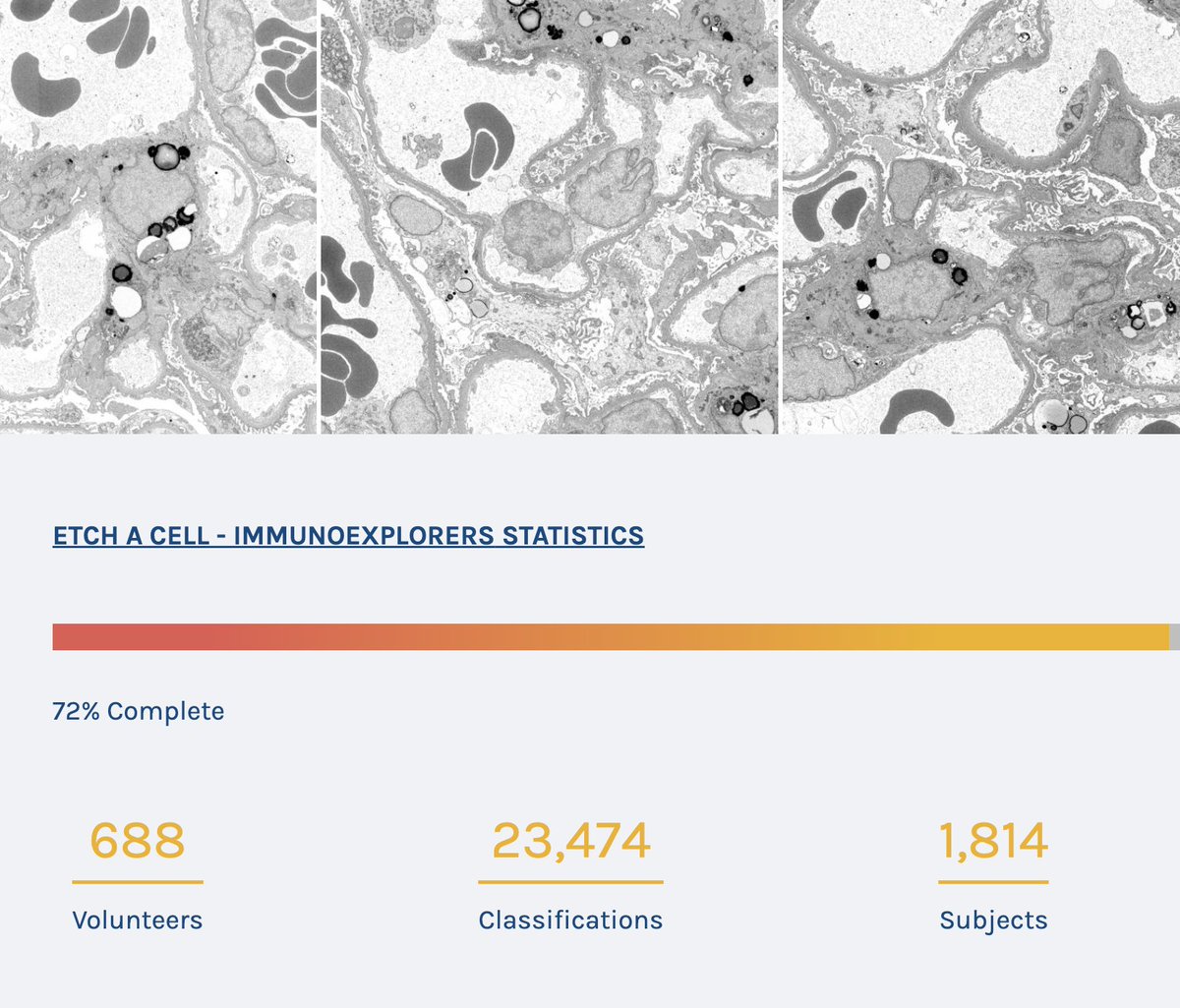 What an incredible first week for Etch A Cell - ImmunoExplorers! 🚀  

✨ 688 volunteers have together contributed 23,474 classifications (and counting!), helping us reach 72% completion of our first dataset.  

Join the effort here: 🔗 zooniverse.org/projects/h-spi…

Thank you 🙌